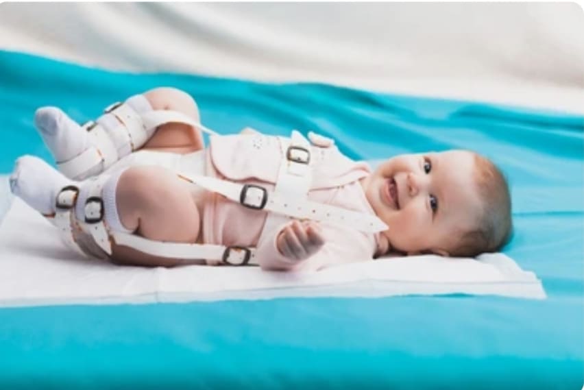 bebe con ortesis en una cama medica sonriendo en ambiente clinico
