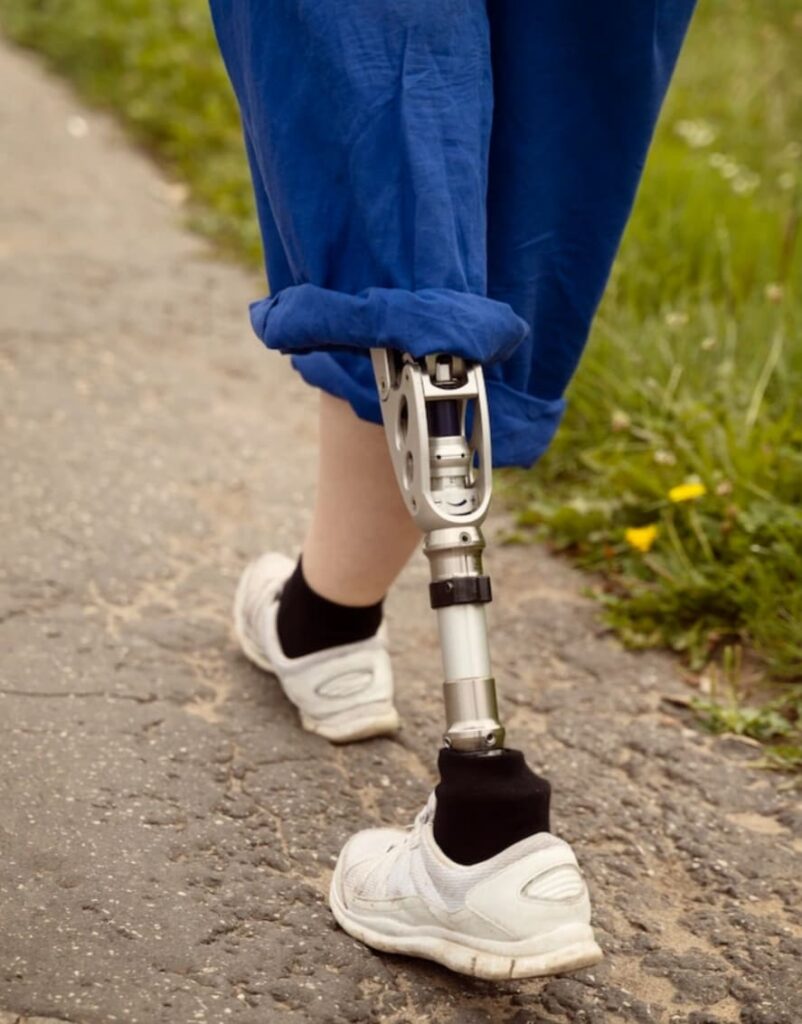 detalle de protesis de pierna en mujer con pantalon azul y zapatillas blancas camino exterior